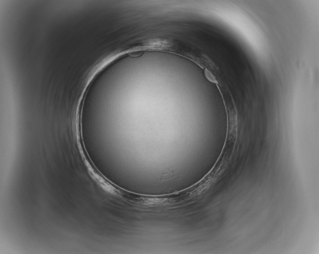 X0000116861439200912221130