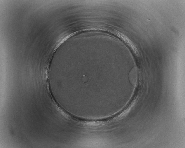 X0000116860985201001051421