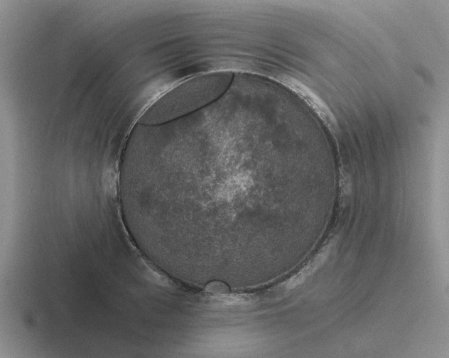 X0000116860993201001051421