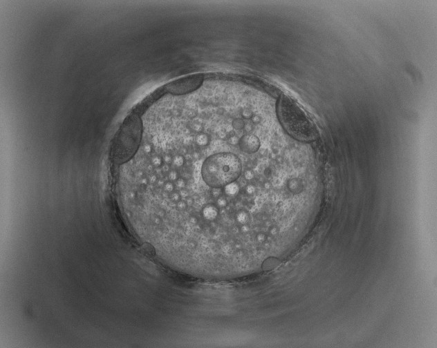 X0000116861215201001051418