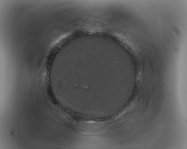 X0000116861398201001051416