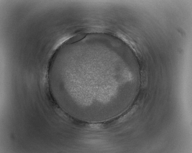 X0000116861453201001051415