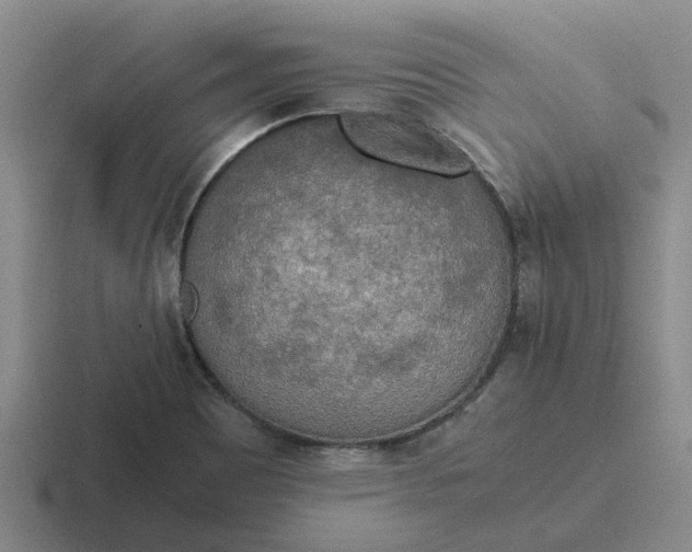 X0000116861465201001051415