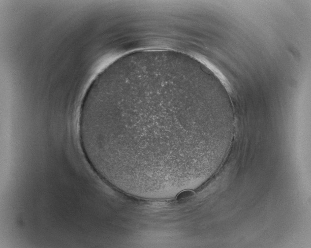 X0000116861477201001051415