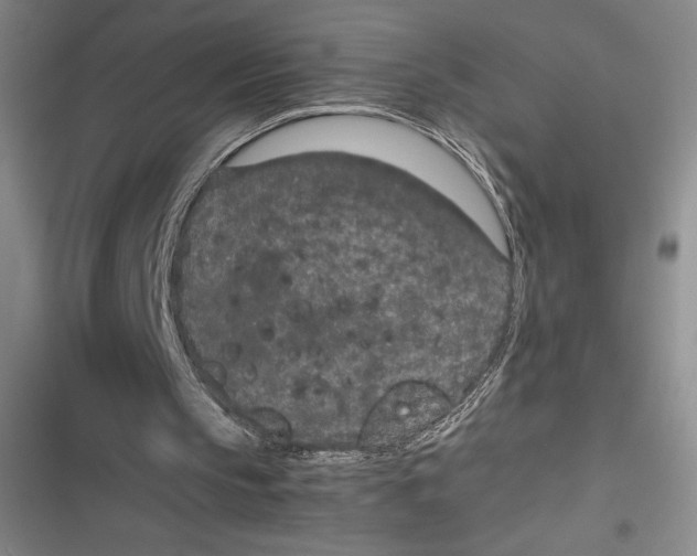 X0000116860145201001121248