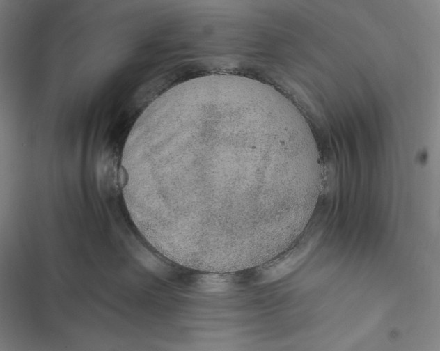 X0000116860238201001121247