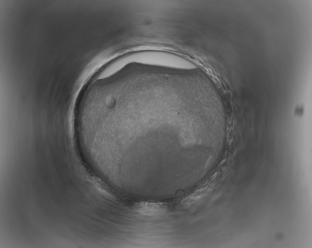 X0000116860296201001121246