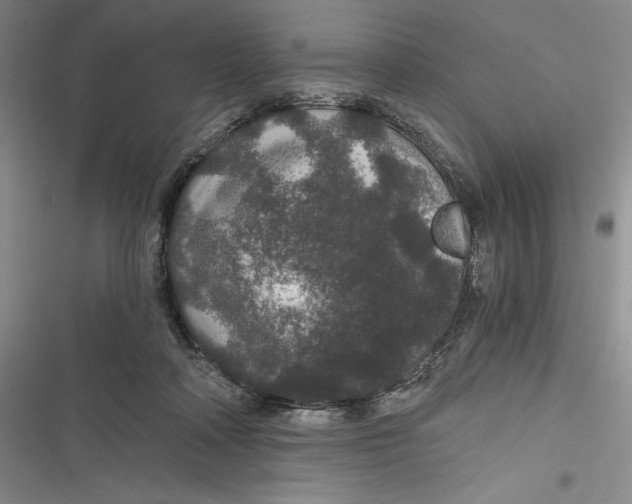 X0000116860314201001121246