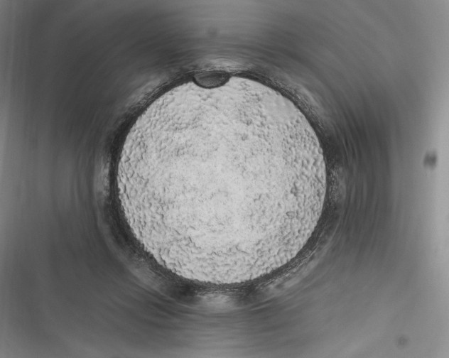 X0000116860358201001121245