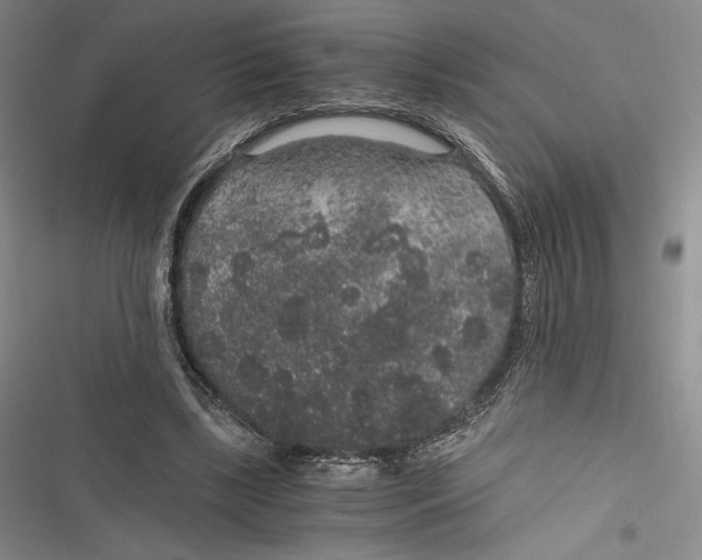 X0000116860443201001121244