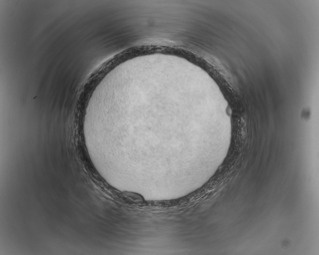 X0000116860872201001121238