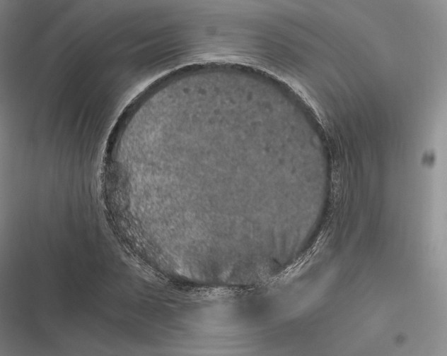 X0000116860879201001121238