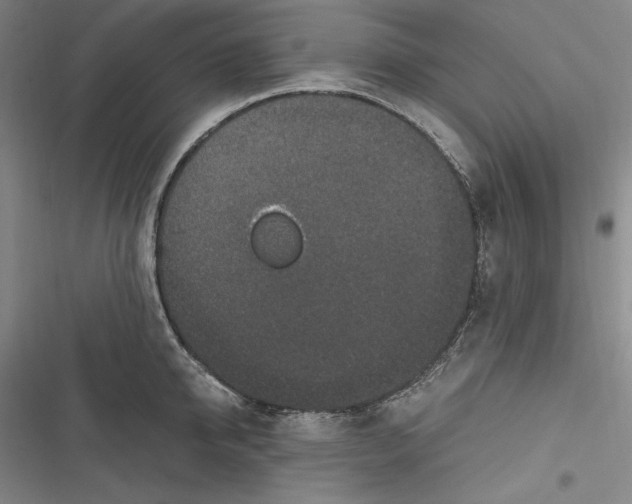 X0000116860950201001121238