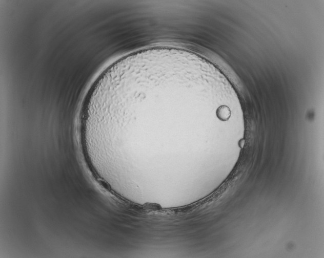 X0000116860955201001121238