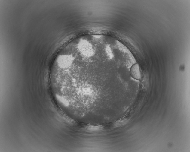 X0000116860314201002021112