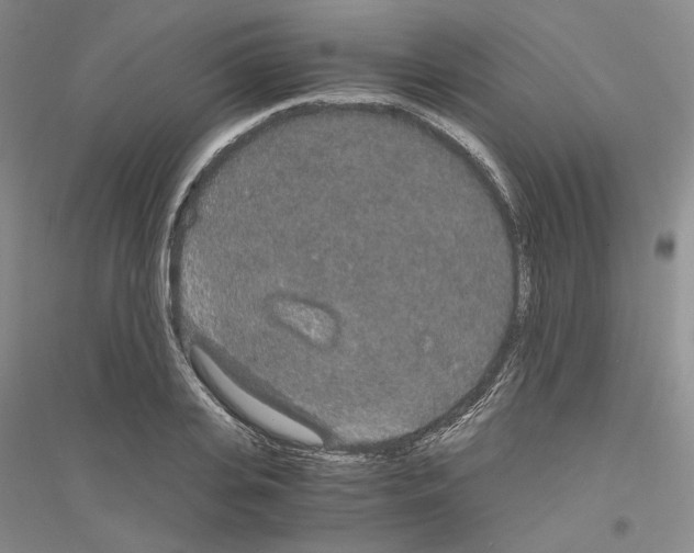 X0000116860935201002021103