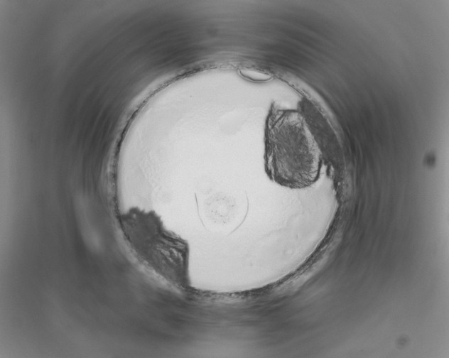 X0000116860957201002021103