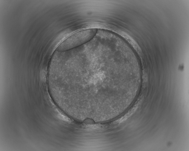 X0000116860993201002021102