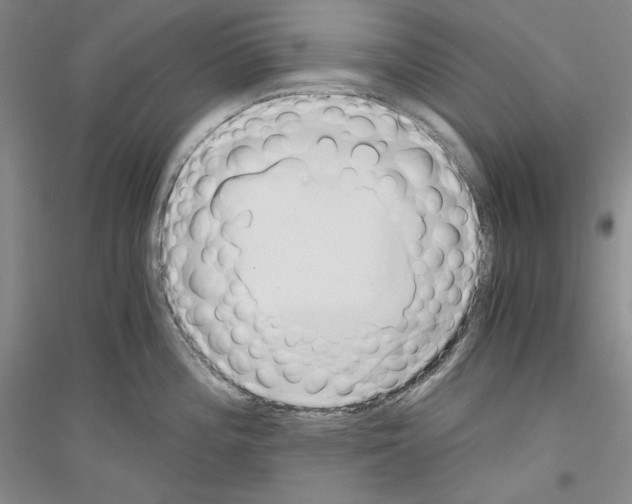 X0000116861196201002021100