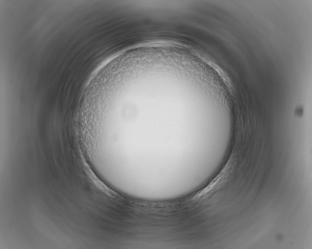 X0000116861417201002021057