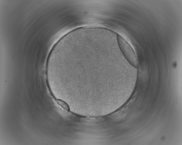 X0000116861485201002021056