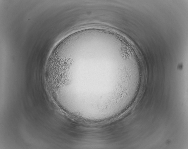 X0000116861514201002021055