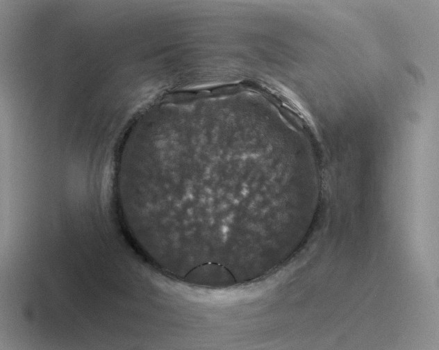 X0000116870018201001051453