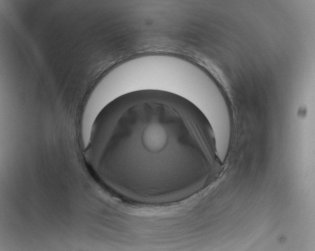 X0000116870017201001121311