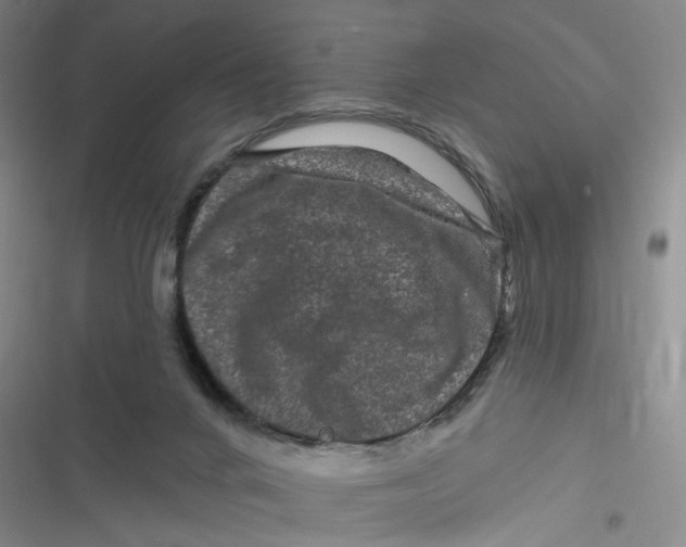 X0000116870024201001121311