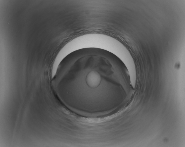 X0000116870037201001121311