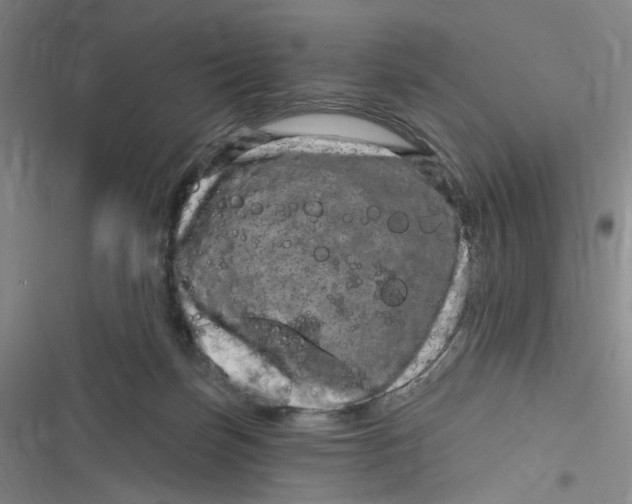 X0000116870171201001121309