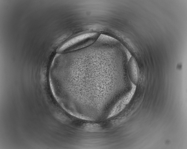 X0000116870403201001121306