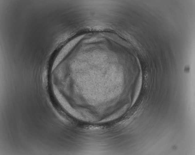 X0000116870638201001121302