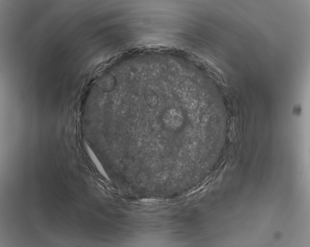 X0000116870917201001121258