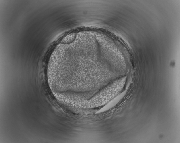 X0000116870968201001121258