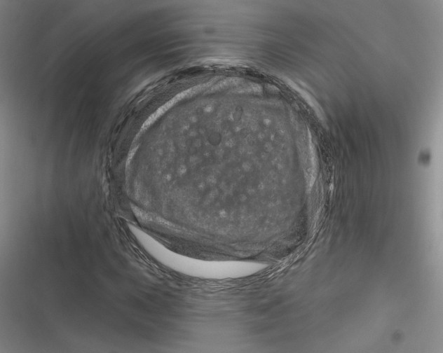 X0000116871015201001121257