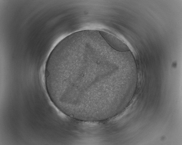 X0000116871103201001121256