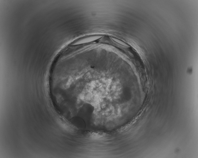 X0000116870346201001191727