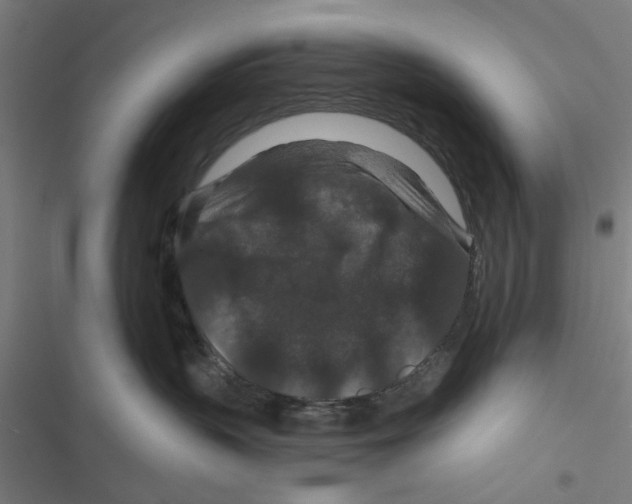 X0000116870383201001191728