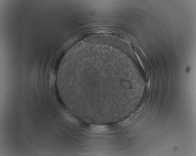 X0000116870476201001191726