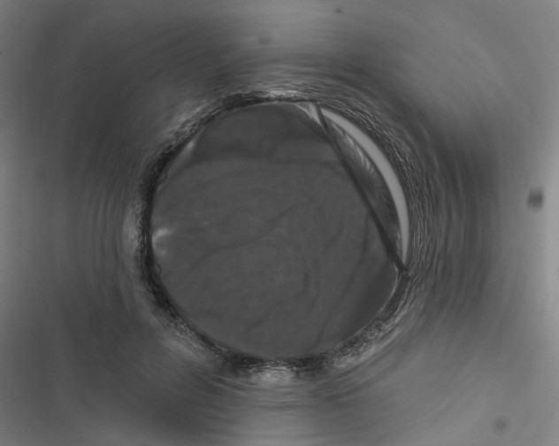 X0000116870600201001191724
