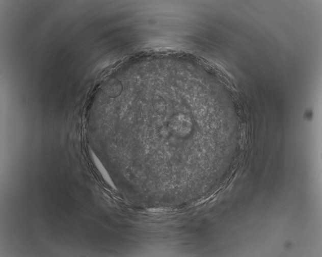 X0000116870917201001191719