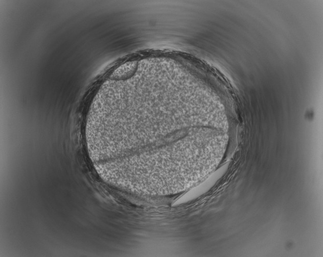 X0000116870968201001191719