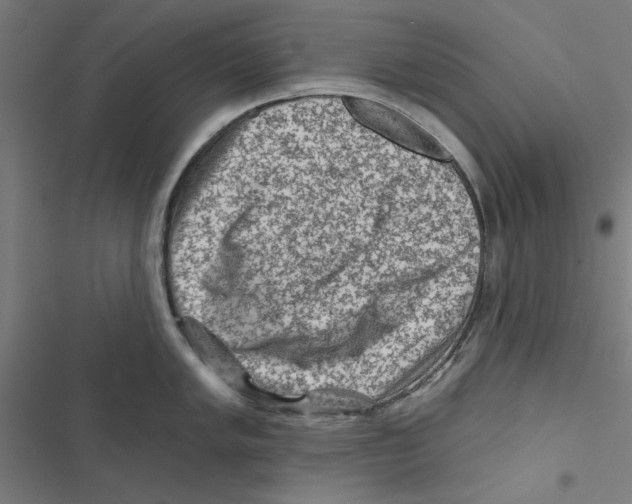 X0000116871005201001191719