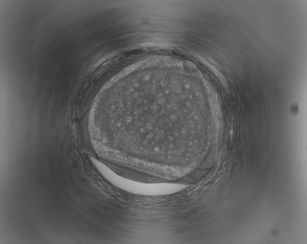 X0000116871015201001191718