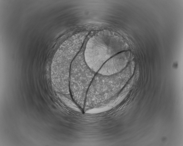 X0000116870964201002021124