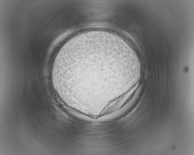 X0000116871406201002021117