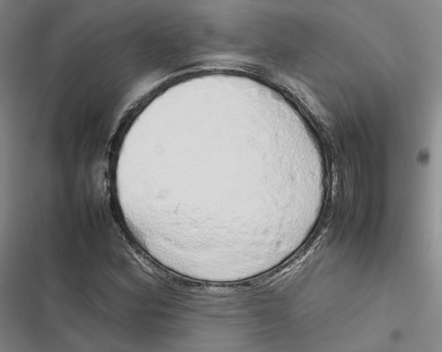 X0000116881164201001121316