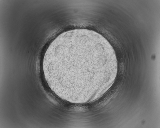 X0000116880638201001191745