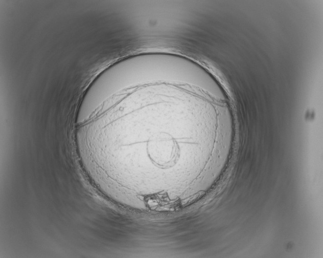 X0000116880385201002021153